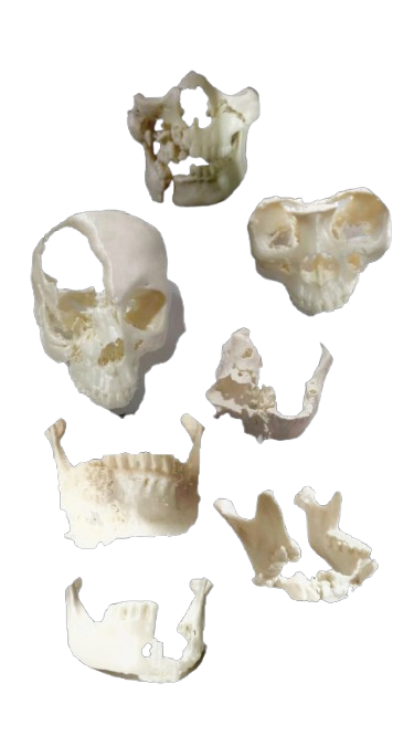 Stereolithography