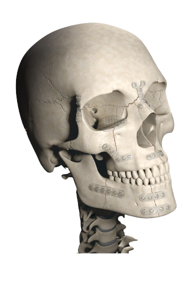 Bioresorbable Implant