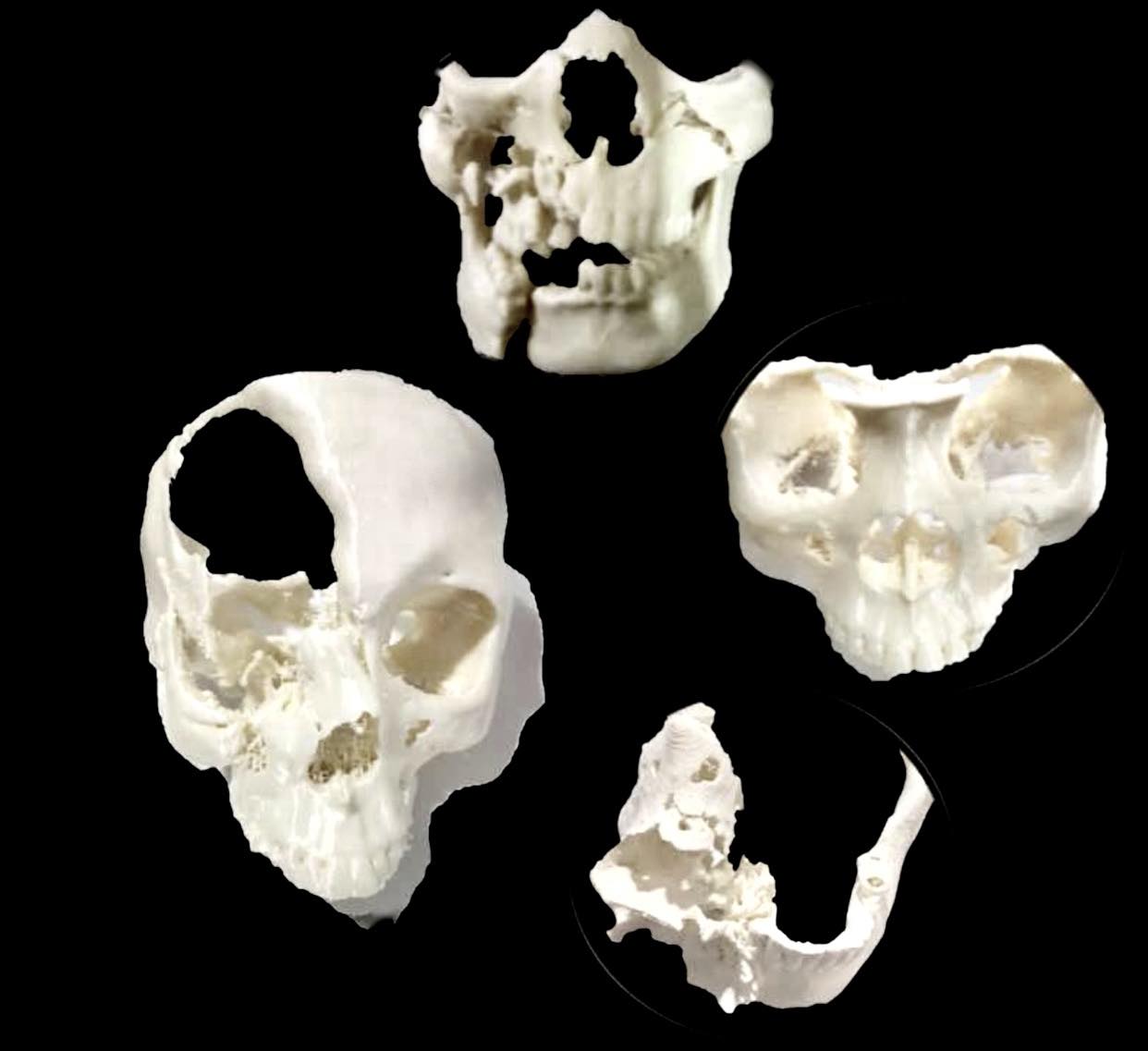 Rebstock Instruments