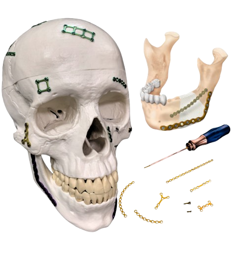 Titanium Implant